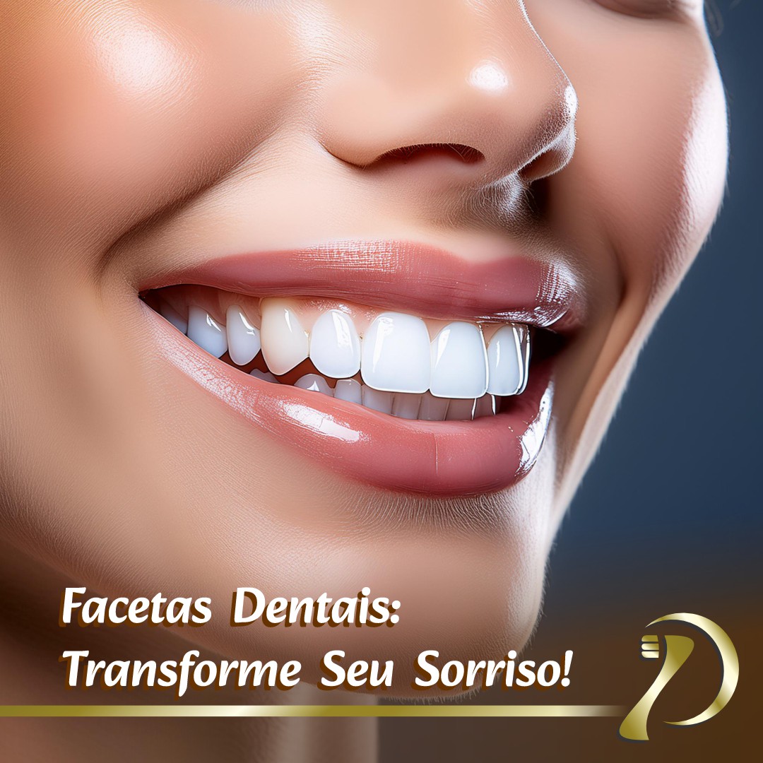 Facetas Dentais - Transforme seu sorriso com conforto e estilo